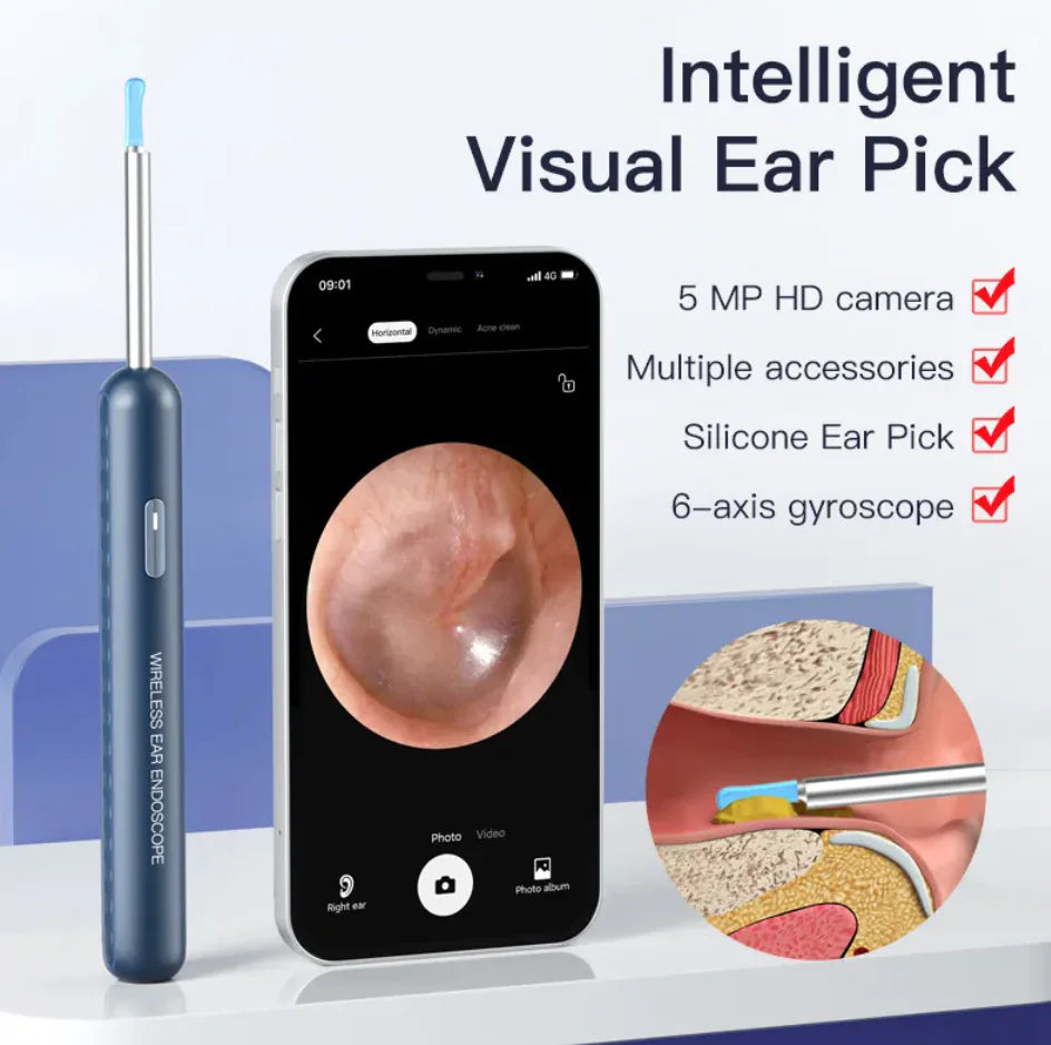 Smart HD Ear Scope Cleaner