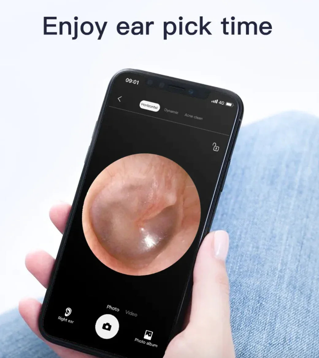 Smart HD Ear Scope Cleaner