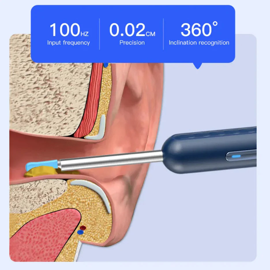 Smart HD Ear Scope Cleaner